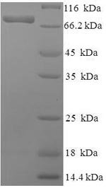 Human Phosphoacetylglucosamine mutase (PGM3) Recombinant Protein, Homo sapiens (Human), E.coli, N-terminal 6xHis-SUMO-tagged, 75.9 kDa, purity >≥ 90% as determined by SDS-PAGE.