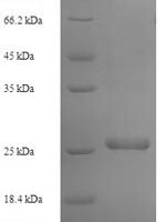 Human Transmembrane protein 98 (TMEM98) Recombinant Protein - BioCrest Sci