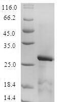 Mouse Lymphocyte antigen 96 (Ly96) Recombinant Protein, N-Flag-Myc - BioCrest Sci