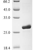 Drosophila melanogaster Small ribosomal subunit protein uS10m (mRpS10) Recombinant Protein, N-His - BioCrest Sci
