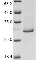 Epstein-Barr virus Secreted protein BARF1 (BARF1) Recombinant Protein, N-10His/C-Myc - BioCrest Sci