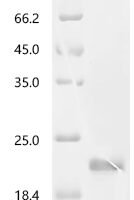 Human Growth/differentiation factor 15 (GDF15), partial Recombinant Protein, C-His - BioCrest Sci