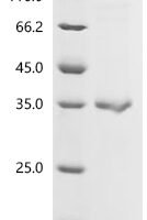 Human C-type lectin domain family 4 member G (CLEC4G), partial Recombinant Protein, C-His - BioCrest Sci