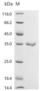 Human C-type lectin domain family 4 member G (CLEC4G), partial Recombinant Protein, C-His, Homo sapiens (Human), E.coli, C-terminal 6xHis-tagged, 33.6 kDa, purity >≥ 90% as determined by SDS-PAGE.