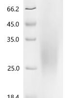 Chicken Platelet derived growth factor subunit B (PDGF-B), partial Recombinant Protein - BioCrest Sci