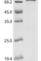 Escherichia coli Chondroitin synthase (kfoC) Recombinant Protein - BioCrest Sci