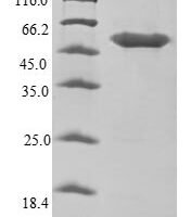 Human Haptoglobin (HP) Recombinant Protein - BioCrest Sci