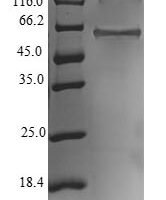 Human E3 ubiquitin-protein ligase NRDP1 (RNF41) Recombinant Protein - BioCrest Sci