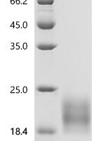 Rat Gastric inhibitory polypeptide receptor (Gipr), partial Recombinant Protein - BioCrest Sci