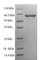 Human Serine/threonine-protein phosphatase 2B catalytic subunit gamma isoform (PPP3CC), partial Recombinant Protein - BioCrest Sci