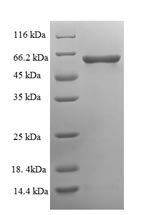 Human Serine/threonine-protein phosphatase 2B catalytic subunit gamma isoform (PPP3CC), partial Recombinant Protein, Homo sapiens (Human), E.coli, N-terminal 6xHis-tagged, 62.0 kDa, purity >≥ 90% as determined by SDS-PAGE.
