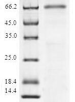 Human NAD-dependent protein deacetylase sirtuin-6 (SIRT6) Recombinant Protein - BioCrest Sci