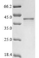 Human Zinc finger protein ZIC 4 (ZIC4) Recombinant Protein - BioCrest Sci