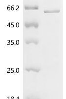 Mouse Glial fibrillary acidic protein (Gfap) Recombinant Protein, C-His, aa 1–430, E.coli - BioCrest Sci