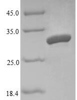 Mouse Angiogenin-4 (Ang4) Recombinant Protein - BioCrest Sci