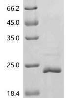 Bovine Alpha-lactalbumin (LALBA) Recombinant Protein, C-His, aa 20–142, E.coli - BioCrest Sci