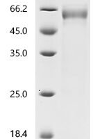 Human Insulin-like growth factor-binding protein 3 receptor (TMEM219), partial Recombinant Protein, C-hFc1 - BioCrest Sci