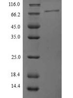 Human Protein phosphatase 1 regulatory subunit 15A (PPP1R15A), partial Recombinant Protein, N-His, aa 40–674, Yeast - BioCrest Sci