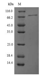 Human Protein phosphatase 1 regulatory subunit 15A (PPP1R15A), partial Recombinant Protein, N-His, aa 40–674, Yeast, Homo sapiens (Human), Yeast, N-terminal 6xHis-tagged, 71.1 kDa, purity >≥ 90% as determined by SDS-PAGE.