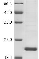 Bovine coronavirus Non-structural protein of 4.8 kDa (4b) Recombinant Protein, N-His-SUMO - BioCrest Sci
