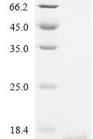 Human Homeobox protein Nkx-3.2 (Nkx3-2), partial Recombinant Protein, C-His, aa 150–250, Baculovirus - BioCrest Sci