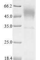 Human Pulmonary surfactant-associated protein A1 (SFTPA1) Recombinant Protein, N-His - BioCrest Sci