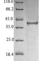Human Hereditary hemochromatosis protein (HFE), partial Recombinant Protein, N-10His/C-Myc - BioCrest Sci