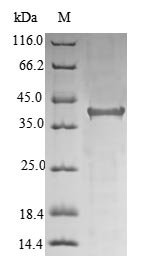 Human Hereditary hemochromatosis protein (HFE), partial Recombinant Protein, N-10His/C-Myc, Homo sapiens (Human), E.coli, N-terminal 10xHis-tagged and C-terminal Myc-tagged, 40.2 kDa, purity >≥ 85% as determined by SDS-PAGE.