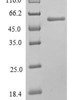 Human Mixed lineage kinase domain-like protein (MLKL) Recombinant Protein, N-His, aa 1–471, E.coli - BioCrest Sci