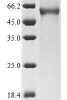 Human Keratin, type I cytoskeletal 24 (KRT24) Recombinant Protein - BioCrest Sci