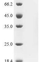 Mouse Alpha-hemoglobin-stabilizing protein (Ahsp) Recombinant Protein, C-His, aa 1–102, Yeast - BioCrest Sci