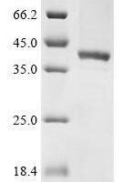 Human Adenylate cyclase type 3 (ADCY3) , Partial Recombinant Protein - BioCrest Sci