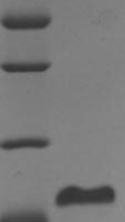 Human Coagulation factor VII (F7), partial Recombinant Protein - BioCrest Sci