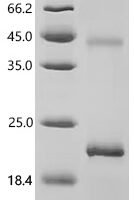 Mouse Acyloxyacyl hydrolase (Aoah), partial Recombinant Protein - BioCrest Sci