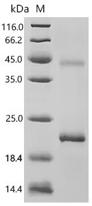 Mouse Acyloxyacyl hydrolase (Aoah), partial Recombinant Protein, Mus musculus (Mouse), E.coli, C-terminal 6xHis-tagged, 20.7 kDa, purity >≥ 90% as determined by SDS-PAGE.