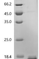 Mycobacterium tuberculosis ESAT-6-like protein EsxK (esxK) Recombinant Protein, N-10His/C-Myc - BioCrest Sci