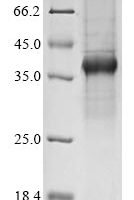 Bovine coronavirus Spike glycoprotein (S), partial Recombinant Protein, C-His, aa 314–634, strain OK-0514 - BioCrest Sci