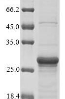 Human Early growth response protein 1 (EGR1), partial Recombinant Protein, N-His-B2M - BioCrest Sci