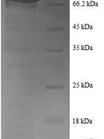 Human Tyrosine--tRNA ligase, Cytoplasmic domain (YARS1) Recombinant Protein - BioCrest Sci
