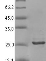 Rabbit  C-X-C motif chemokine (CXCL9) Recombinant Protein - BioCrest Sci