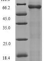 Escherichia coli RNA-splicing ligase RtcB (rtcB) Recombinant Protein - BioCrest Sci