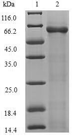 Escherichia coli RNA-splicing ligase RtcB (rtcB) Recombinant Protein, Escherichia coli (strain K12), E.coli, N-terminal 6xHis-SUMO-tagged, 61.2 kDa, purity >≥ 90% as determined by SDS-PAGE.