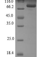 Human Steroid 21-hydroxylase (CYP21A2) Recombinant Protein - BioCrest Sci