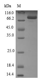 Human Steroid 21-hydroxylase (CYP21A2) Recombinant Protein, Homo sapiens (Human), E.coli, N-terminal GST-tagged, 82.9 kDa, purity >≥ 85% as determined by SDS-PAGE.