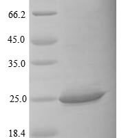 Mouse Interleukin-34 (Il34) Recombinant Protein, Tag-Free - BioCrest Sci