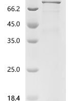 Human Protein turtle homolog A (IGSF9), partial Recombinant Protein, C-His - BioCrest Sci