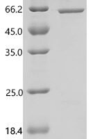 Human Ran-binding protein 3-like (RANBP3L) Recombinant Protein, C-His-Flag, aa 1–465, E.coli - BioCrest Sci