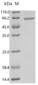 Human Ran-binding protein 3-like (RANBP3L) Recombinant Protein, C-His-Flag, aa 1–465, E.coli, Homo sapiens (Human), E.coli, C-terminal 6xHis-Flag-tagged, 54.2 kDa, purity >≥ 85% as determined by SDS-PAGE.