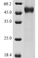 Human Interleukin-15 (IL15) Recombinant Protein, C-hFc1-Myc - BioCrest Sci