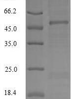 Macaca fascicularis Apolipoprotein C-III (APOC3) Recombinant Protein, N-MBP/C-His - BioCrest Sci